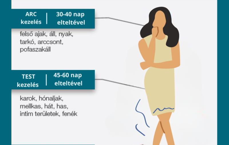 Dióda lézeres alkalmak alakulása a szőrnövekedési idő figyelembevételével 99 Kezelesi ido valtozasa a szornovekedes figyelembevetelevel 2
