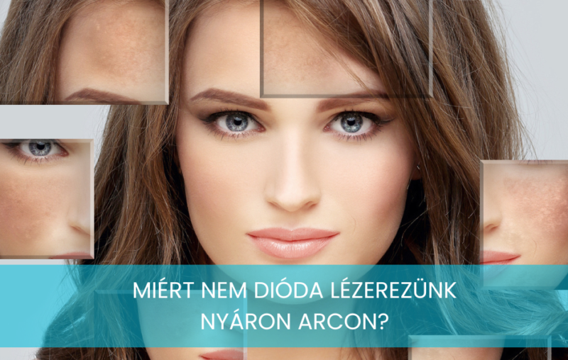 Miért nem szabad az arcon dióda lézerezni nyáron? 91 dioda lezer nyaron arc