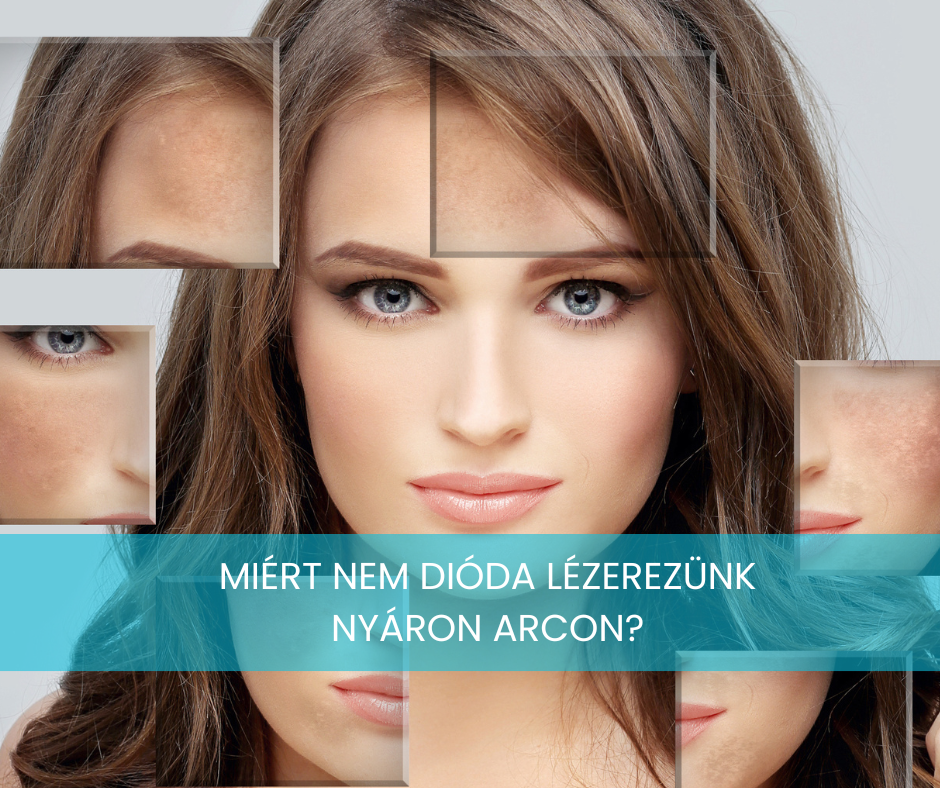 Miért nem szabad az arcon dióda lézerezni nyáron? 15 dioda lezer nyaron arc