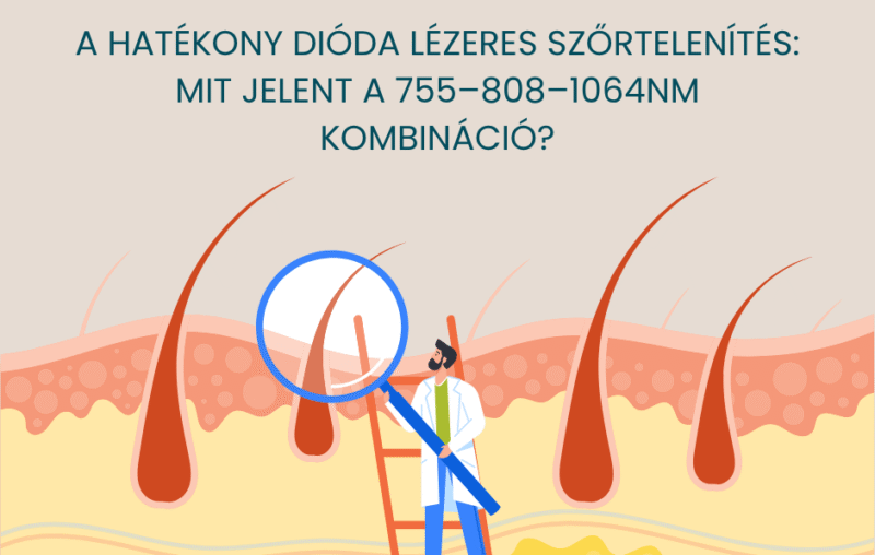 A hatékony dióda lézeres szőrtelenítés titka: mit jelent a 755–808–1064 nm kombináció? 83 hatekomny dioda lezeres szortelenites