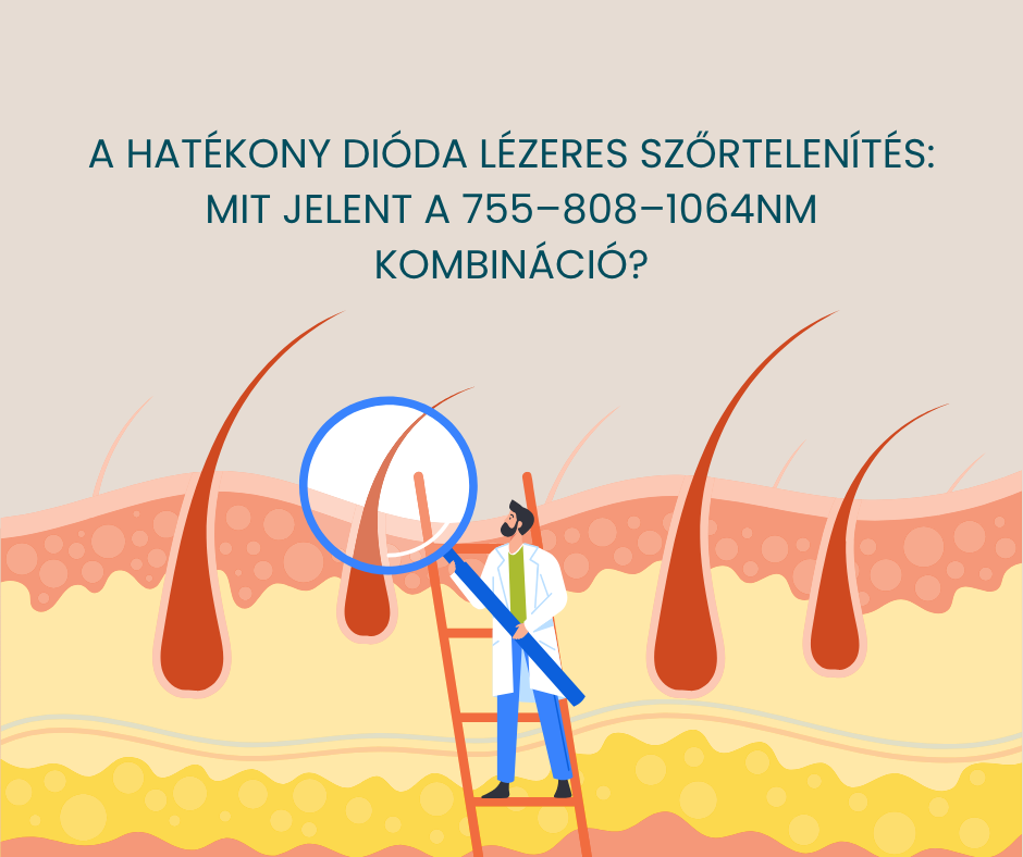 A hatékony dióda lézeres szőrtelenítés titka: mit jelent a 755–808–1064 nm kombináció? 15 hatekomny dioda lezeres szortelenites