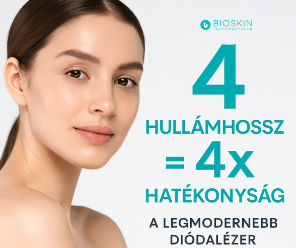 Miért jobb a 4 hullámhosszú diódalézer a tartós szőrtelenítéshez? 67 4h